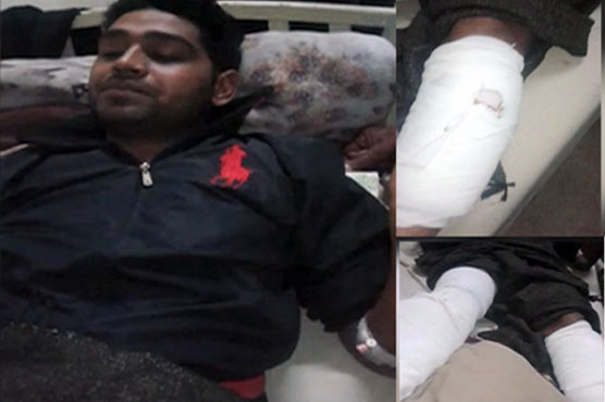 Lahore: Feudal tortures, shoots barber in both legs