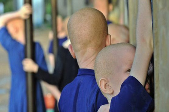 Albino killers sentenced to death in Tanzania