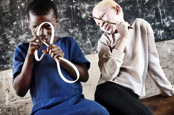 Seven held in Tanzania over latest albino attack
