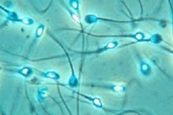 Probe sees link between semen quality, pesticides