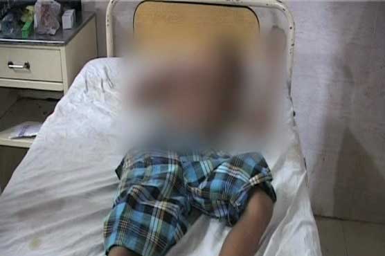 Landlord sets child ablaze on suspicion of burning fields