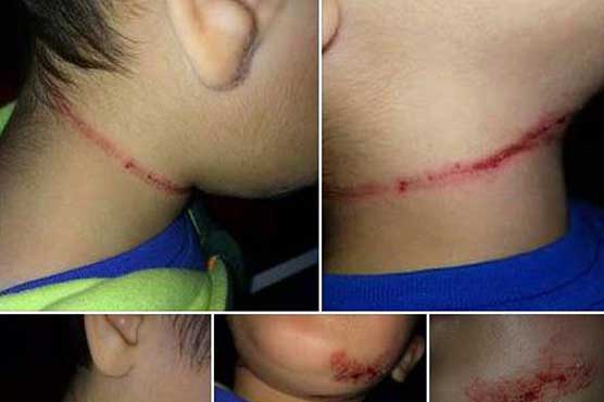 Belgian teacher hangs 5-year-old Muslim child by neck