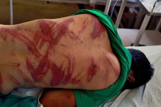 Hospital in Indian Occupied Kashmir filled with beating, shooting victims