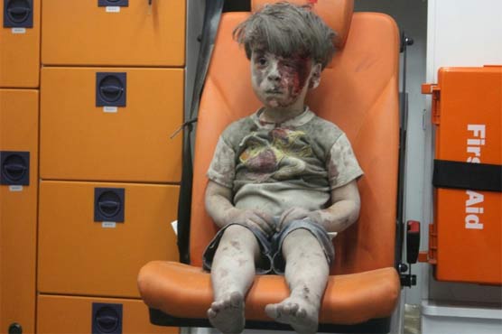 Brother of Omran, Syrian boy in haunting picture, dies of wounds 