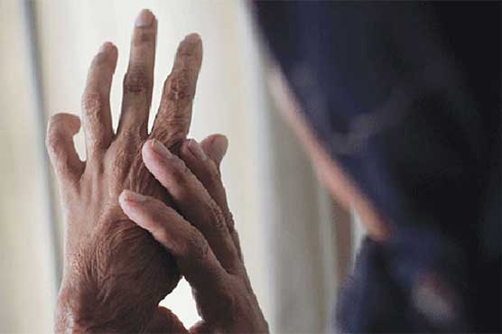 Rawalpindi girl suffers serious burns in acid attack