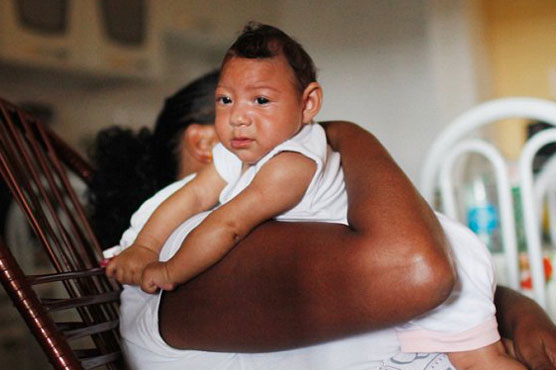 Colombia fears 'explosion' of nerve disease from Zika 