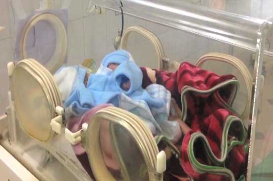 Conjoined twins pass away in Multan