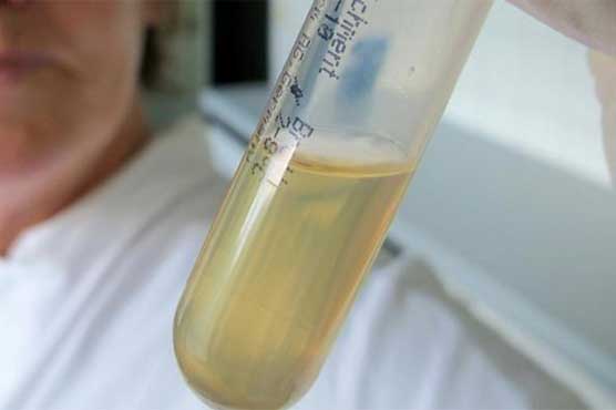 Dutch open their first 'poop bank' to treat gut diseases