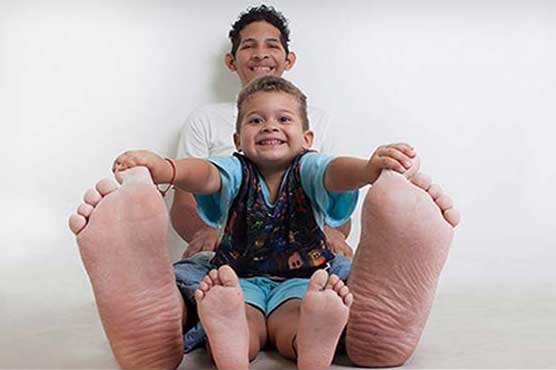 Man with world's largest feet receives welcome gift