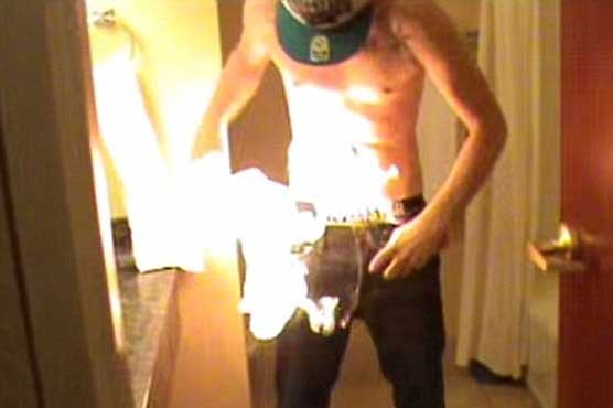 Teens film 'fire stunt' to post footage online