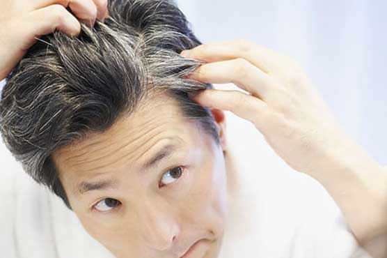 Gene holds key to (no) grey hair: study