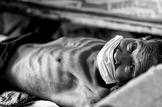 Pakistan, US working closely to end tuberculosis from the country: Ambassador Jillani