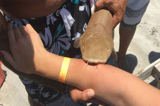 US woman rushed to hospital with shark stuck to arm