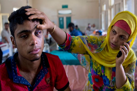 1100 Kashmiris suffer eye injuries from pellet guns fired by Indian troops