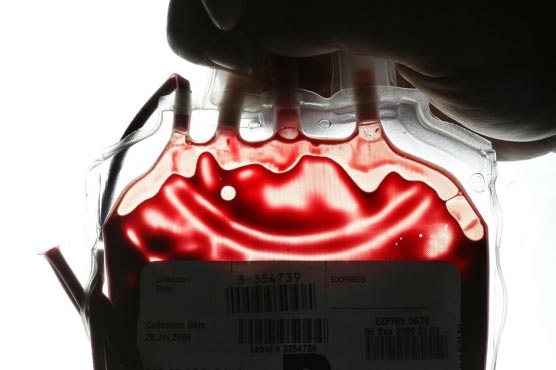 Young blood makes old mice smarter: study