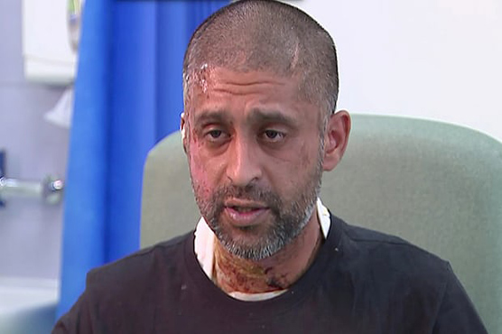 London acid attack: Assault victim Jameel Mukhtar says he’s ruined for life