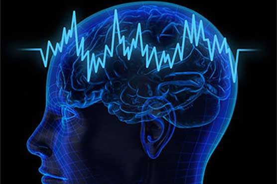Depression: New brain imaging method pinpoints areas of origin