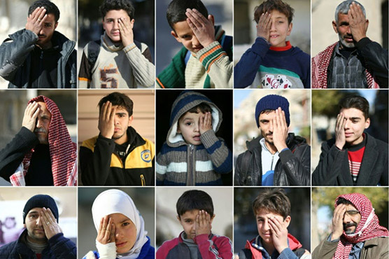 Blinded in one eye, Syrian baby becomes symbol of siege