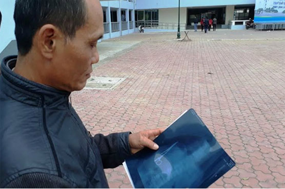 Scissors pulled from Vietnam man's stomach 18 years after surgery