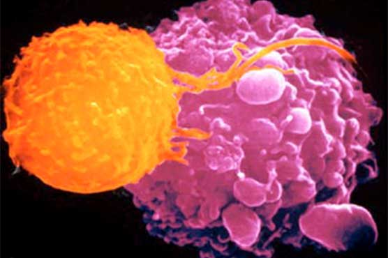 Cancer spread cut by 75% in tests