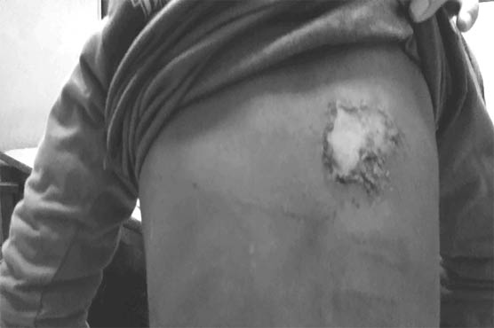 Multan: 8-year-old child worker tortured by shopkeeper