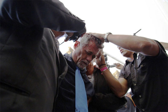 Venezuela gov't backers beat opposition lawmakers in congress