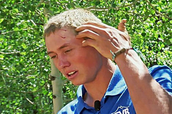 Colorado camper wakes to find bear biting head