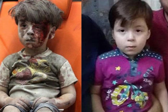 New photos appear of Syrian boy injured in Aleppo airstrike