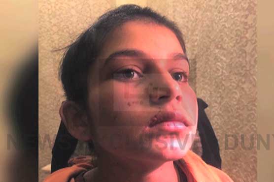 Woman tortures minor maid, cuts off hair in Islamabad