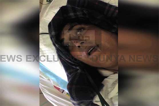 Woman succumbed to injuries after being stabbed by husband