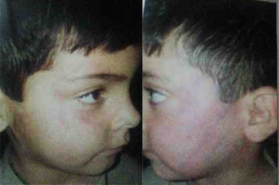 Police arrest 'fake pir' for torturing minor boy in Islamabad