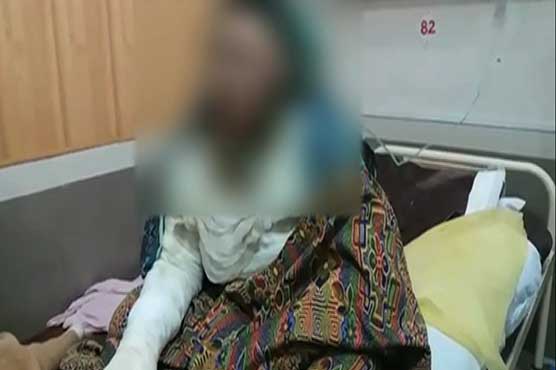 Ruthless man throws acid on wife over domestic issue in Sadiqabad