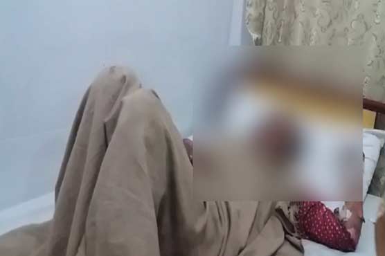 Young man burned 20 year old girl with petrol over refusal of marriage 