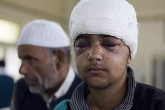 Rights group urges India to ban shotgun pellets in occupied Kashmir