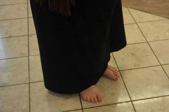 US woman hasn't worn shoes in three years