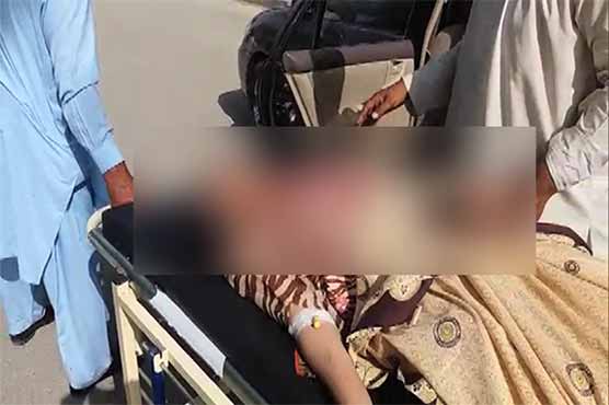 Three female students of UOG doused in acid