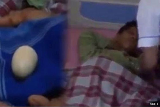 Indonesian boy stuns doctor by laying an egg 