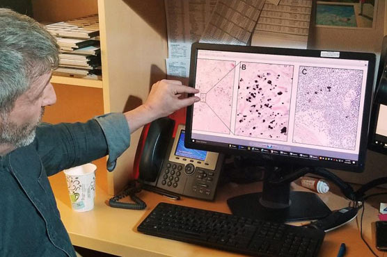 Overlooked 'organ' could play role in cancer spread