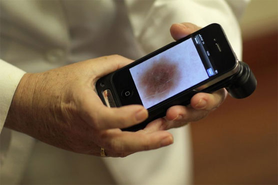 AI better at finding skin cancer than doctors: study