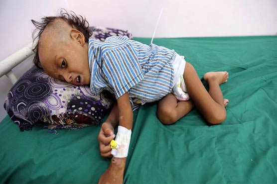 Up to 85,000 children 'dead of starvation or disease in Yemen'