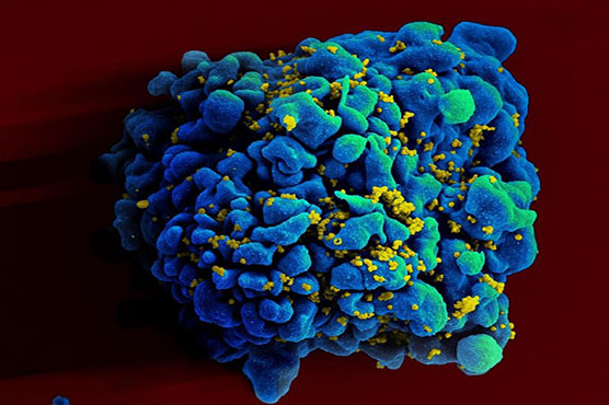 Immunotherapy pulls HIV virus out of hiding to kill it