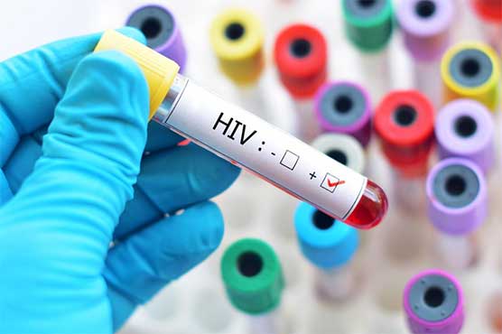 HIV cases on rapid rise in Khyber Pakhtunkhwa