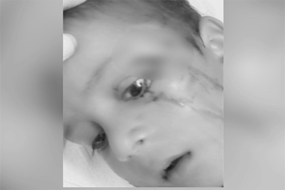 Dog attack injures five in Karachi