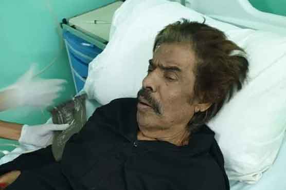 Singer Shaukat Ali's condition worsens in battle against liver disease