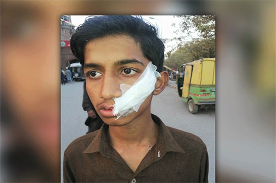 Kite string injures youth in Shahdara