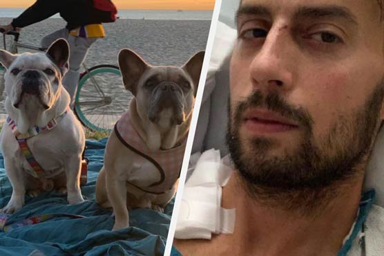 Lady Gaga's dog walker says he is recovering from 'very close call with death'
