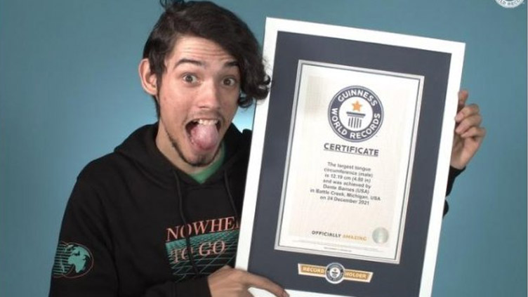 US man's tongue circumference earns Guinness World Record