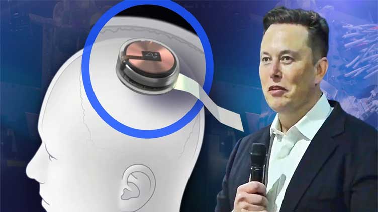  Musk's Neuralink faces federal probe, employee backlash over animal tests