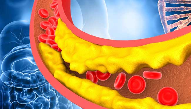 Maintaining heart health through eating healthy foods