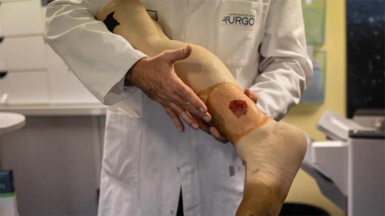 Dressing 'revolution' seeks artificial skin for burn victims